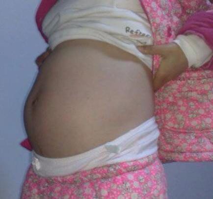 十七歲女孩意外懷孕，經檢查肚子裡有２０多條老鼠的圖片搜尋結果